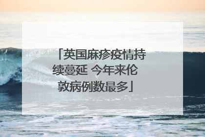 英国麻疹疫情持续蔓延 今年来伦敦病例数最多